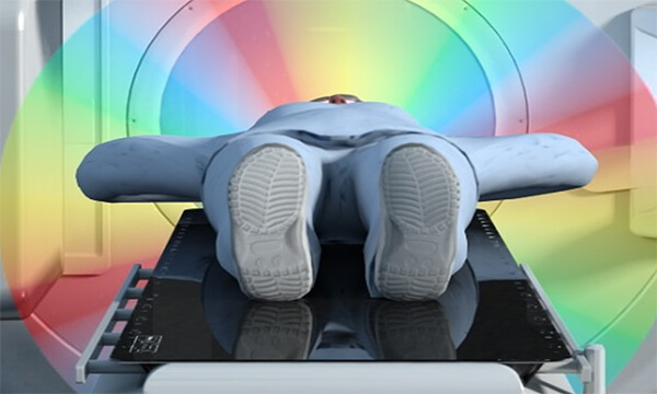 4D RTP Planning with Cone beam CT