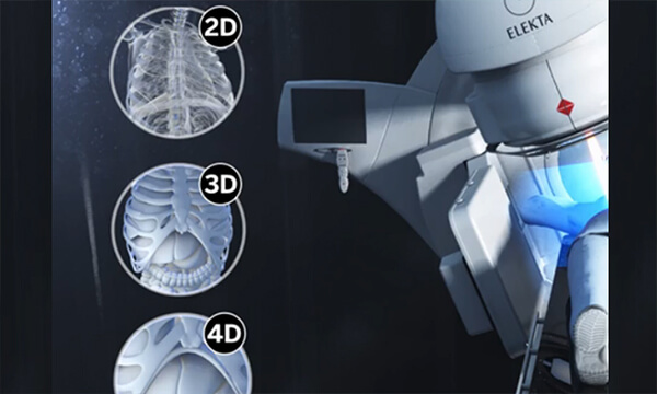 Advanced Image Guidance & Motion Management