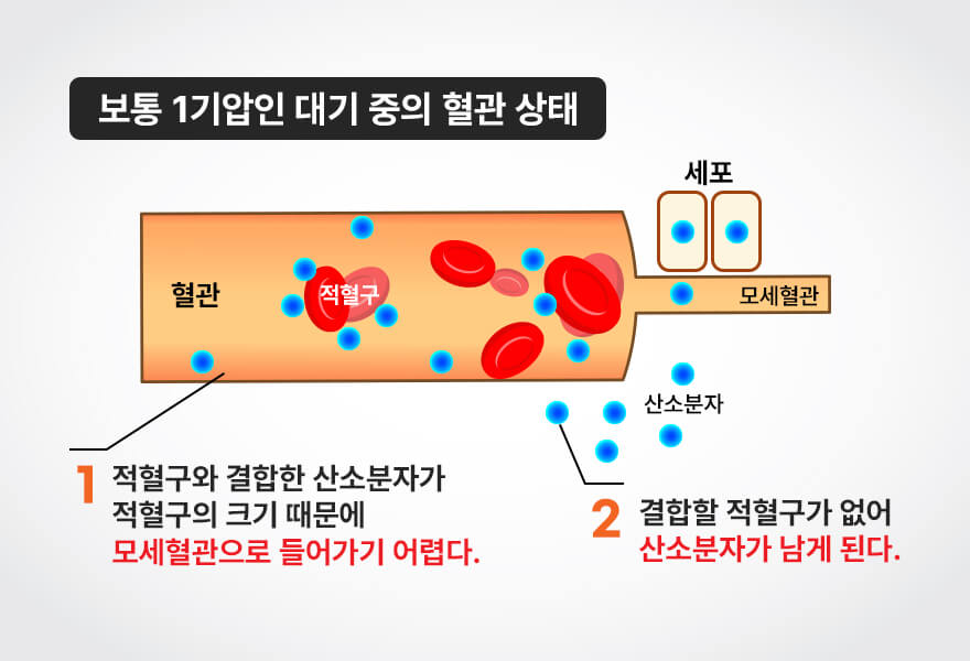 고압산소요법의 원리 이미지