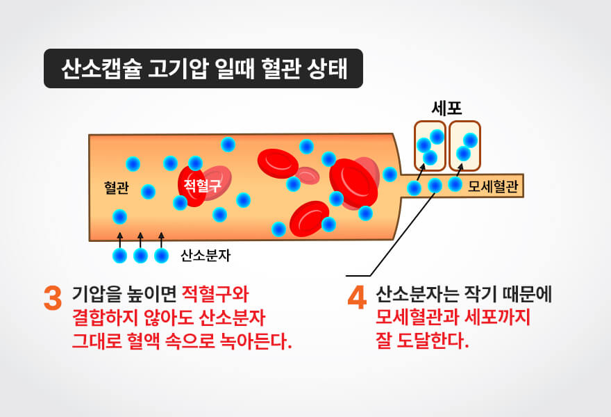 고압산소요법의 원리 이미지